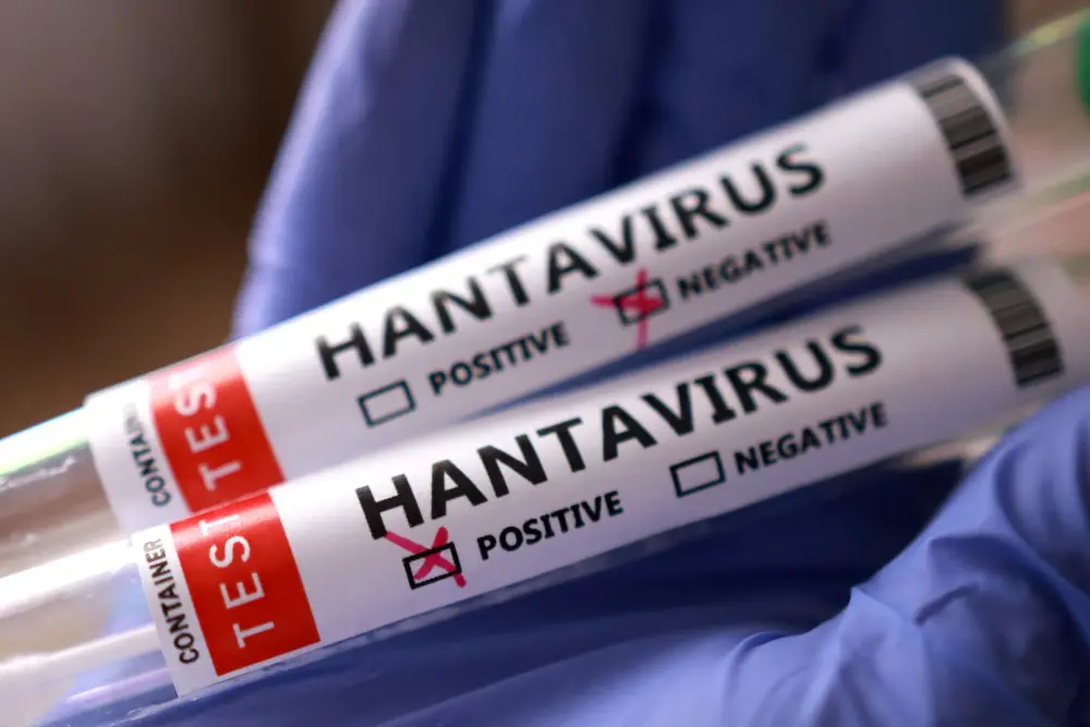 Hantavirus 2026: The Deep-Dive into the MV Hondius Outbreak